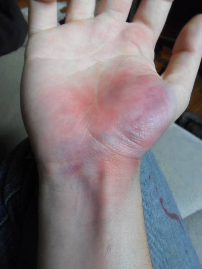 Now that I've added the darker blue to few areas and blended it with my base layers, the overall look of the bruise is more dynamic.