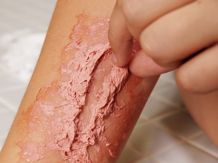 Let the glue dry a bit and continue to shape and raise the edges so that the wound looks jagged and gory.