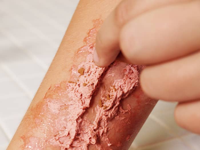 7. Sprinkle cocoa powder around the edges to darken the wound. This gives the appearance of cut flesh.