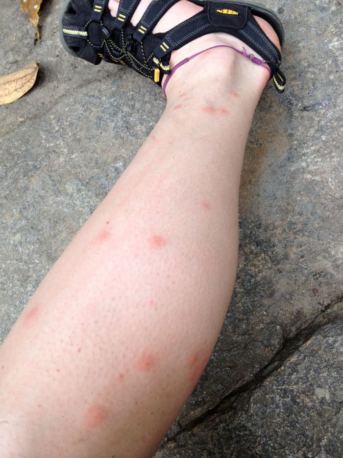 Insect Repellent Tips For Thailand - Wanderwisdom