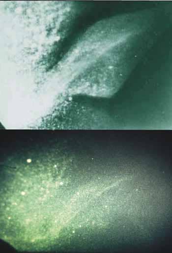 The famous flipper photos...before and after. It turned out they were fakes and were exposed by Shine in 1989