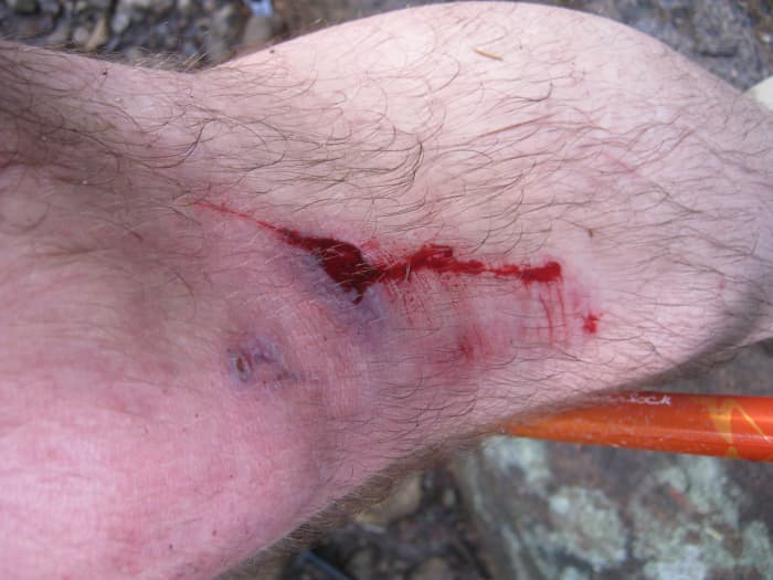 Knowing when enough is enough and when to turn around is an important skills for hikers. First aid is also important.