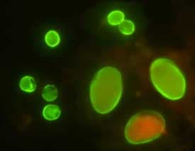Cryptosporidium (left) and Giardia (lower right). The two most common intestinal-problem-causing bacteria in water.