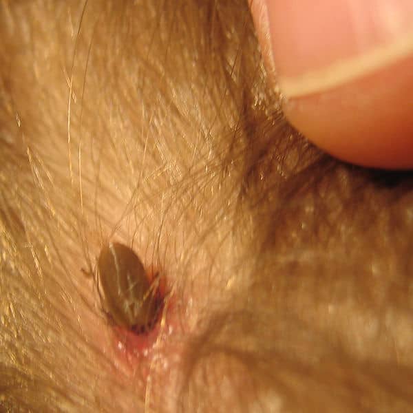 Zecken können sich nahe an der Haut verstecken und tödliche Keime übertragen.