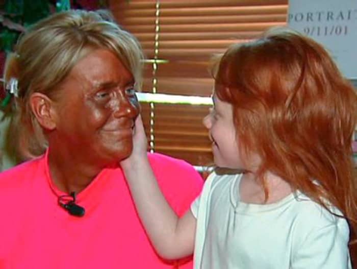This is how "I" almost ended when I became hopelessly in tanning every day years ago.