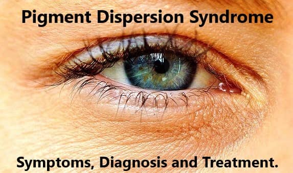 Pigment Dispersion Syndrome. A condition of the eye that requires long term treatment to hold back the effects of increased pressures of the eye on your vision.