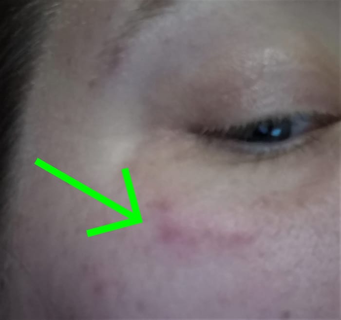 So, I have no idea what I do while I sleep, but I will oftentimes wake up with new bumps and bruises. I like to make up fun stories about fighting ninjas and saving babies from runaway trains.