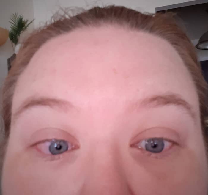 To decrease puffiness, I cut up a cucumber and placed the slices on my eyes. What resulted was itchiness, redness, and pain. Never again.
