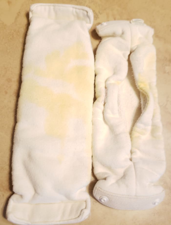 After over 2 month of use a few of the diapers are stained, but there is no odor when washed properly.