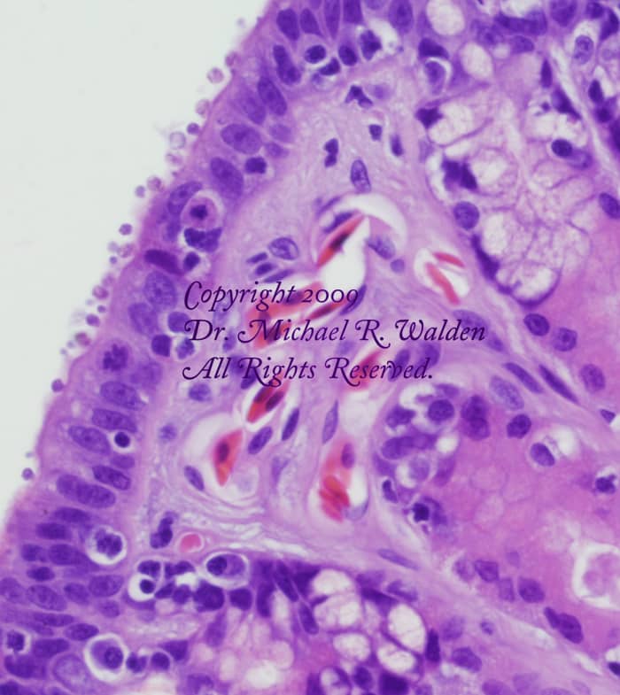 Stomach of Elaphe obsoleta lindheimeri. Coccidia of the genus Cryptosporidium are visible on the surface as small round objects just above the mucosa.