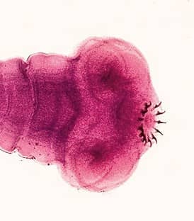 The tape worm attaches to the intestine with a scolex (picture here) it then absorbed nutrients directly through its skin.