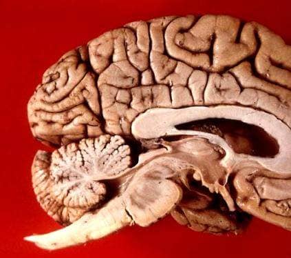 The many folds of the brain are filled with cerebrospinal fluid (CSF) to keep it cushioned, fed, and to clean out wastes. The CSF replaces itself completely 3.7 times per day.