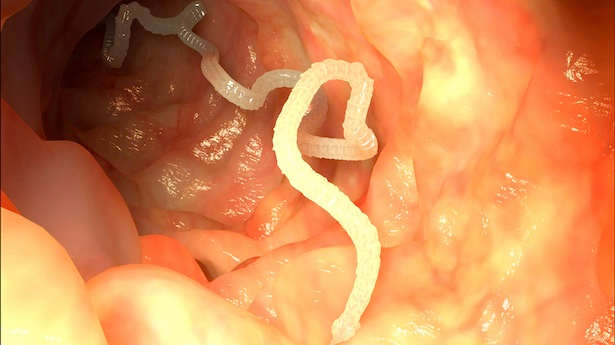 Tapeworms attach themselves to the intestinal wall and begin to absorb nutrients through their skin.