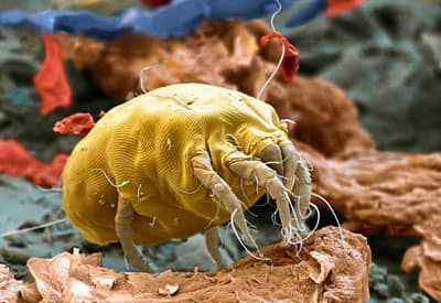 You can with careful cleaning and the other tips above control and eliminate dust mites from your house. But its a long term thing that your going to have to keep doing.