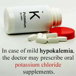 Your doctor will advise if you need to take pottasium cholride if you are suffering from Hypokalemia. Also seek medical advice if you are unsure about your health.