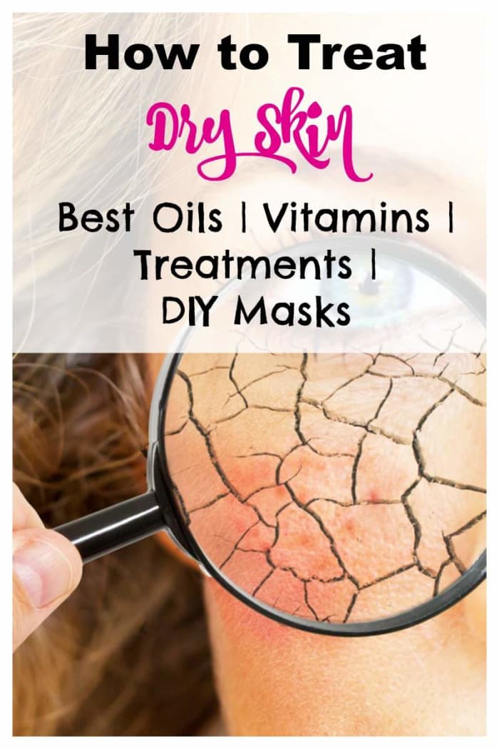 How do you treat dry skin? Keeping the skin moisturized with the right products, natural ingredients and a proper diet