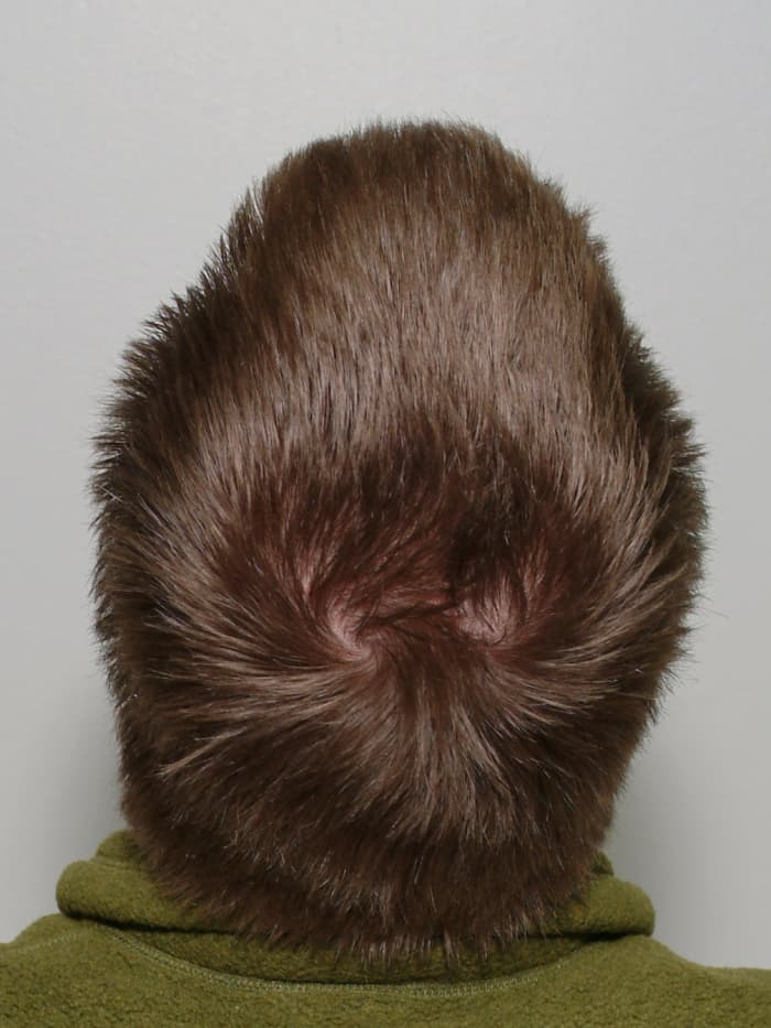 Some people get really worked up about natural hair whorls, crowns and hairlines.