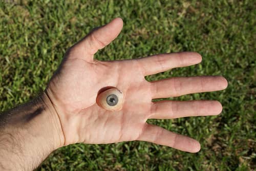 There are so many misconceptions about prosthetic eyes, and I hope that by writing this article I can help clarify them.
