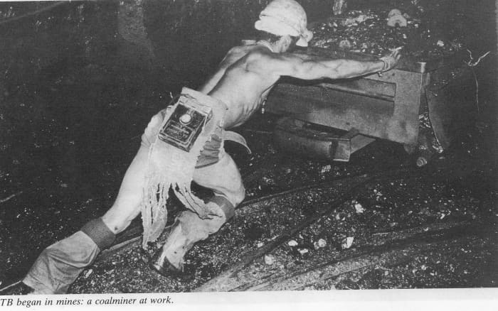 TB began in the mines, and migrant labor was resposible for depopulating the African farms, along with the Hut and dog taxes, for instance,a the Baccilus that was gotten form the other European workers and the unhealthy mine working conditions/diet