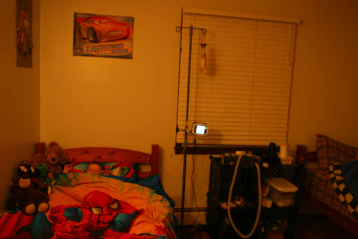 The author's five year old son receives supplemental nutrition overnight via a g-tube.