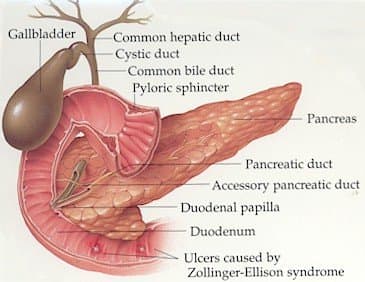 Pancreatitis and How it Can Ruin Your Life - HubPages