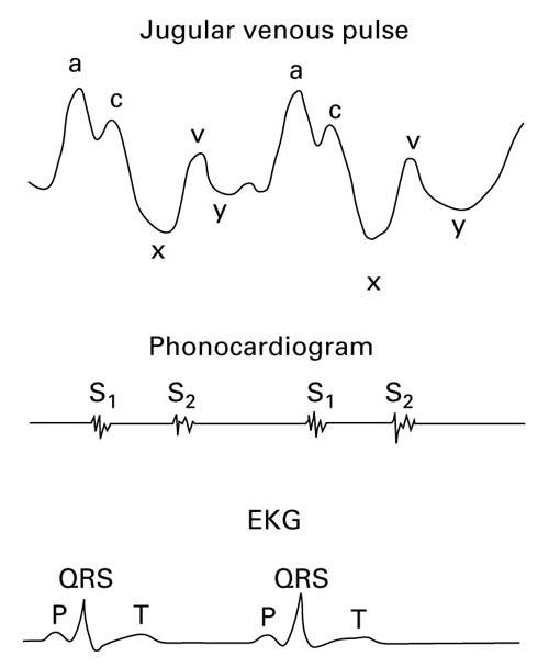 The waves a, c and v and the troughs x and y are also studied. The jugular vein is a low pressure system and therefore, the waves are occluded easily by palpation.