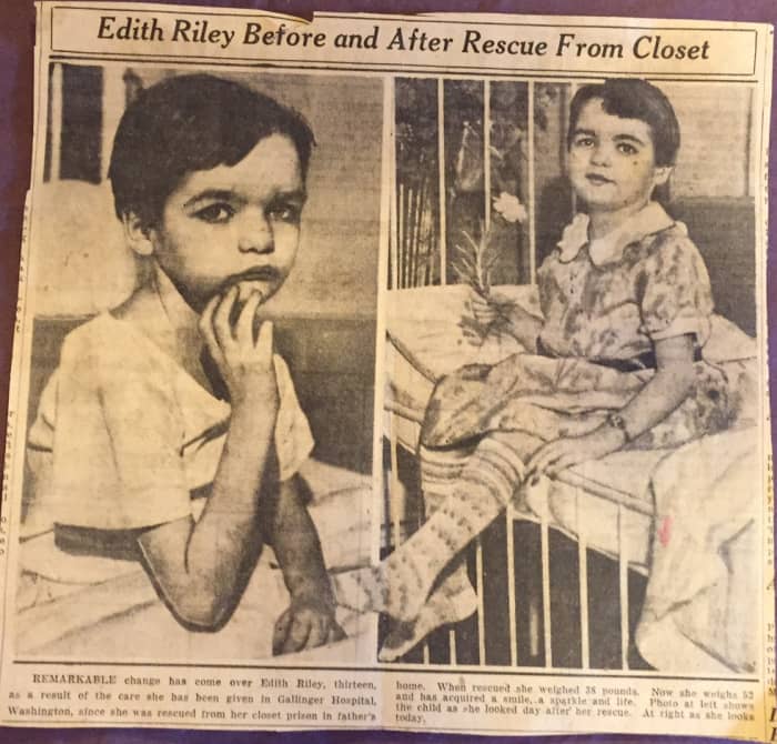 Edith Riley, of Washington State, before and after her rescue from the closet in which her parents imprisoned her.