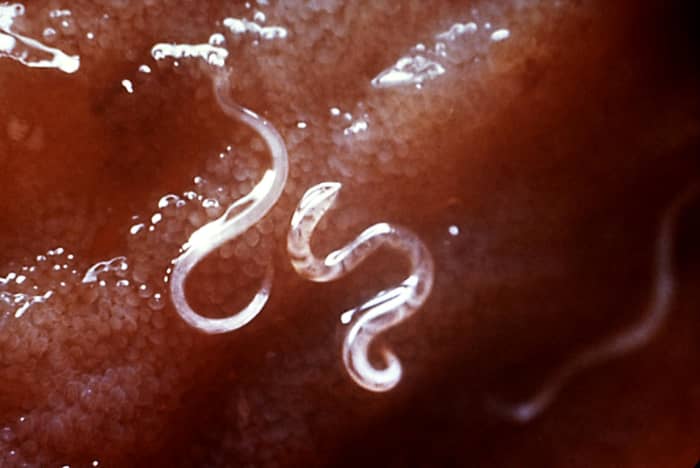 Hookworms attached to inside of intestine