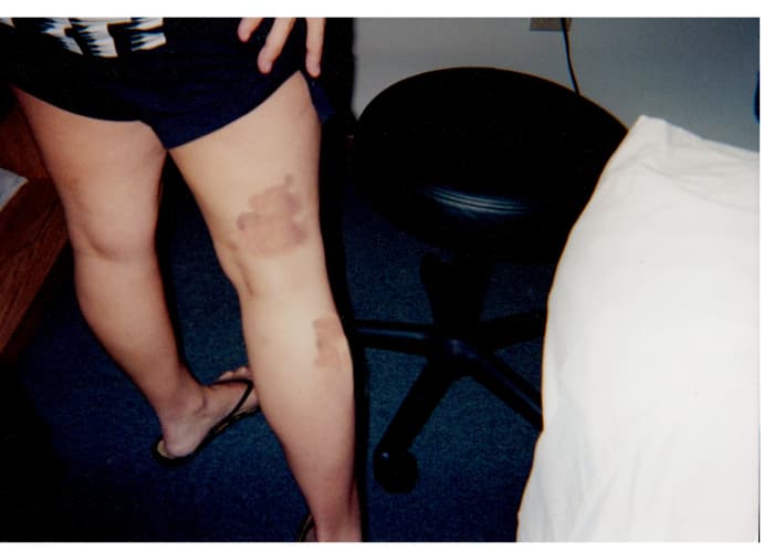 These were the pictures the solicitor didn't take for court. These were not from the hospital insident.