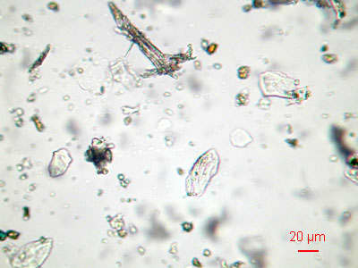 This is what "dust" looks like under a microscope. Busy looking stuff, isn't it? (source: funsci.com)