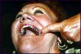 Mouths filled with gold; this was the judgement of God thru Moses due to God's people committing idolatry in the desert.