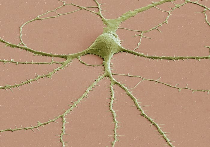 Photomicrograph of a neuron’s cell body (top, center) and its dendrites radiating out of it, obtained with a scanning electron microscope.