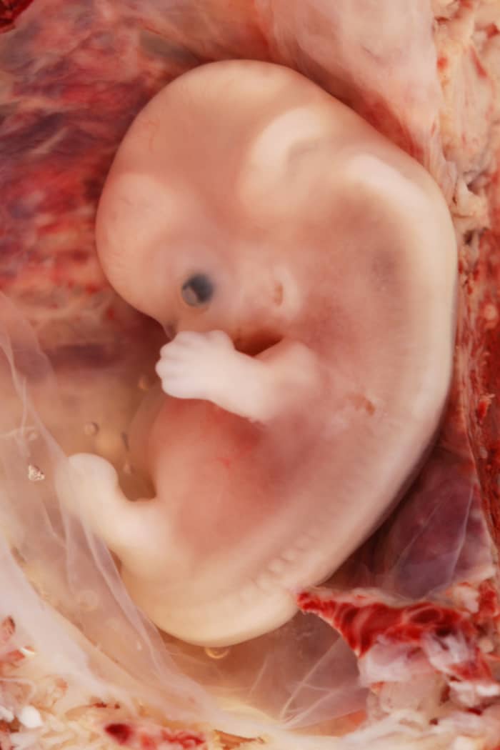 This is a human embryo at 9 weeks, and it is VERY possible for a 12 year old girl to become pregnant with a tiny human child. Make no mistake; even children as young as 9 can become pregnant!