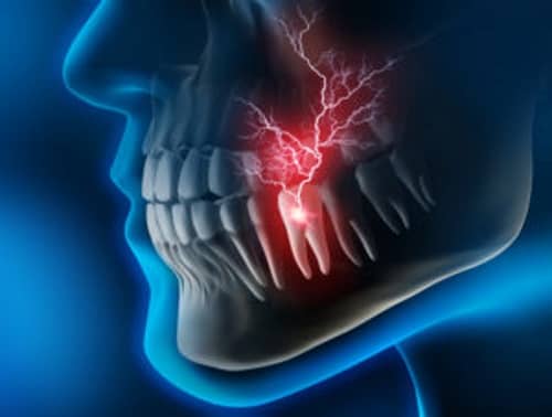 A few symptoms of oral galvanism: Abnormal muscle contractions of the jaw, metallic taste, inability to focus, memory problems, migraines, and tooth pain.