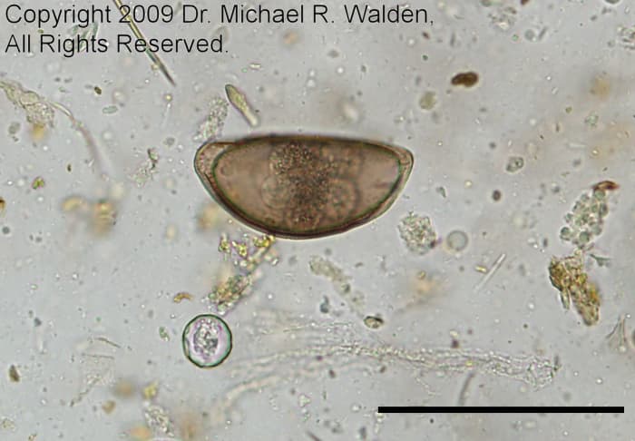 Oxyurid ovum with coccidia oocyst of Isospora amphiboluri. Bar = 100 microns. 200x. Used with permission.