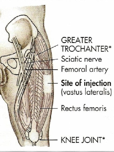 Landmarks include the greater trochanter and the knee joint. Divide the road in half between these landmarks and inject in the outer part of the thigh.