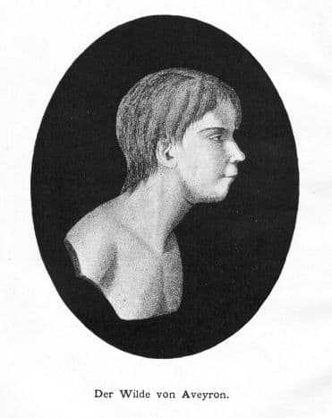 "Victor" was the first scientifically studied feral child. No one knows where he came from but he was found living alone in the wilderness.