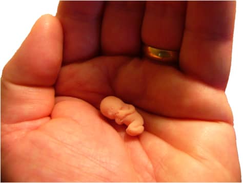 There are times when creating a miracle requires a helping hand. The most common female infertility factor is an ovulation disorder.