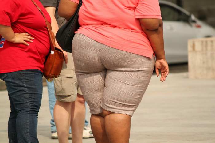 This is what an obese or overweight person looks like which is caused by a variety of factors including bad dietary choices & a lack of exercise.