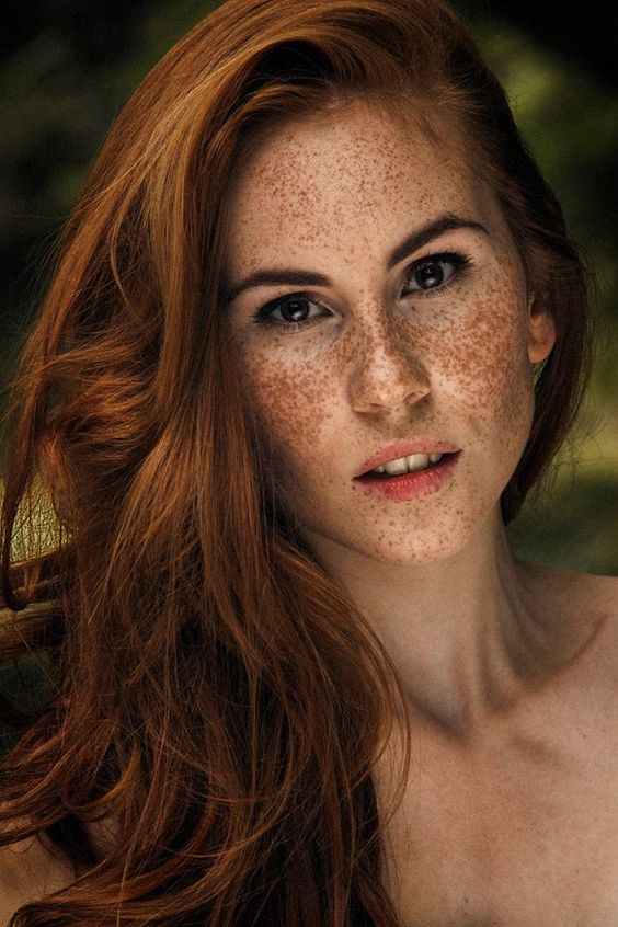 Martina Vyberciova is a Slovakian print model and her freckled face has been no deterrent to her beauty or her success.