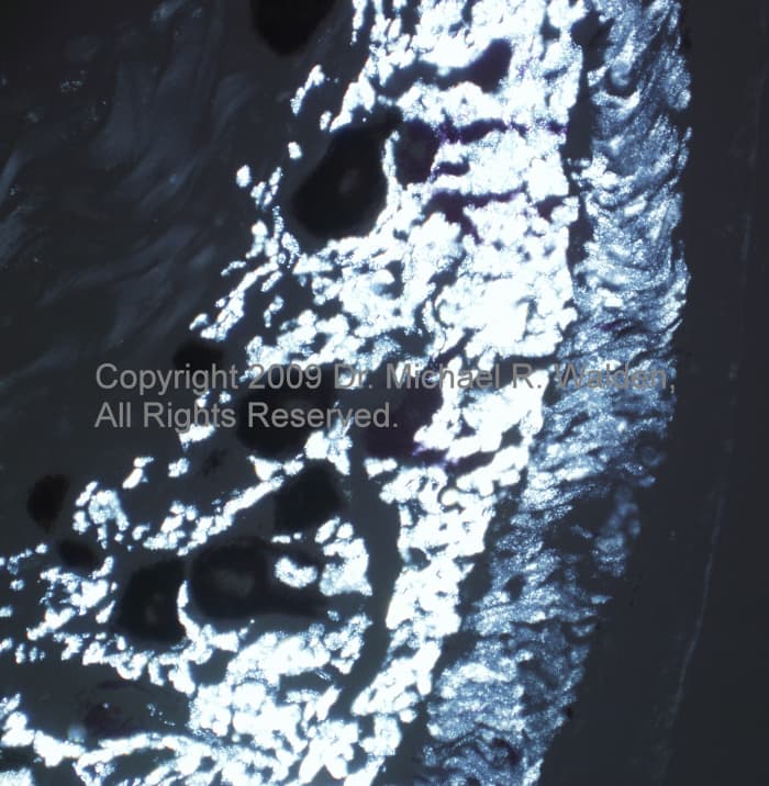 Same section as above under polarized light microscopy. The polarized light reveals the birefringence of the iridophore platelets and makes the two distinct rows of iridophores even more distinct.
