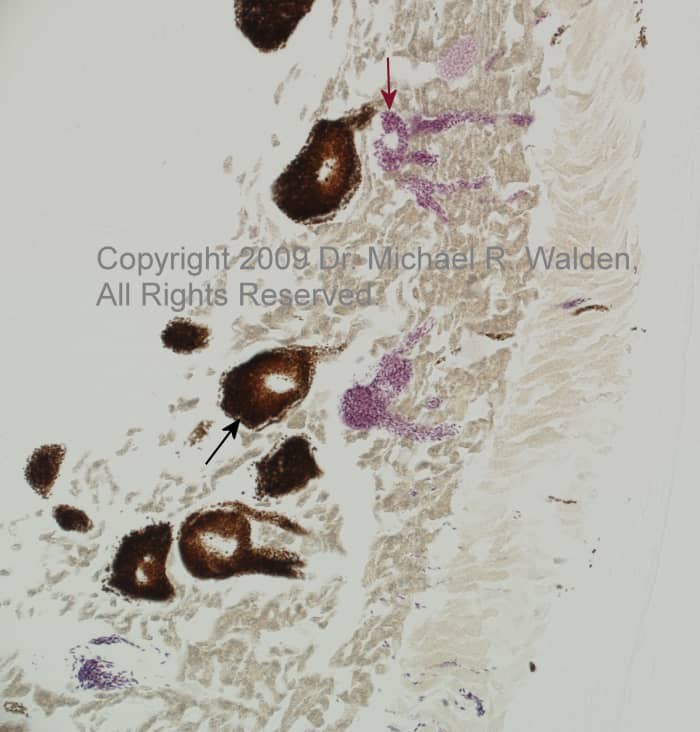 Unstained histopathology slide from a Chameleon. Melanophores (black arrow) and erythrophores (red arrow) are clearly visible. The iridophores appear in this section as golden brown and there are two distinct rows. Deep margin on left.
