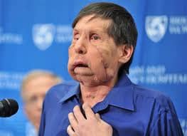 chimpanzee xanax