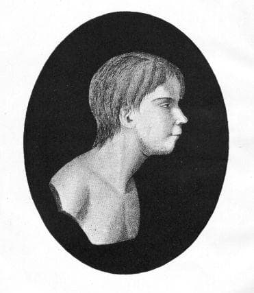 Victor of Aveyron, although being studied close to 200 years earlier, was a strikingly similar case.