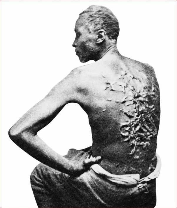 Lashing scars cover the back of this slave; punishments and their severity varied, but lashing was common for perceived insubordination