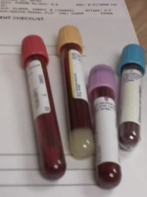 Tiger Top Tube/Gold Tube (Polymer Gel) Can be used as Red Tube. This tube is spun around in the centrifuge.