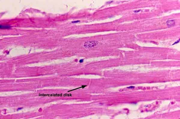 Human anatomy: An overview of smooth, cardiac and skeletal muscles ...