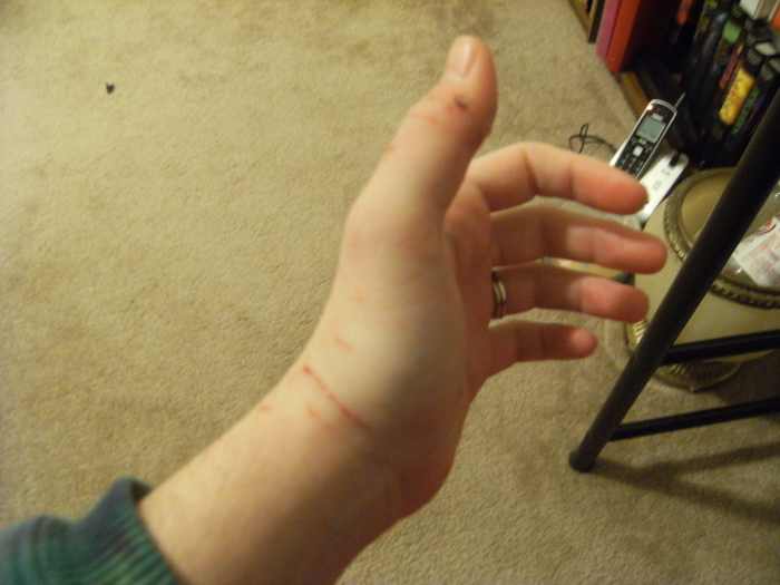 Treating Cat Bites and Scratches HubPages