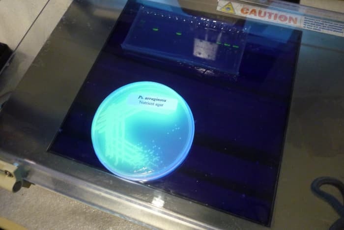 Pseudomonas aeruginosa is an interesting bacterium. It contains a pigment that fluoresces under UV light. It can form biofilms in the lungs and on medical equipment.