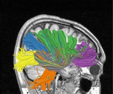 Scientists are studying complex wiring of the brain to build the computer of the future, one that combines the brain's ability for sensation, perception, action, interaction, cognition, consumption, compact size creating computational theory